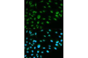 Immunofluorescence analysis of HeLa cells using MCM7 antibody.