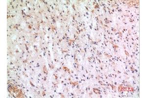 Immunohistochemistry (IHC) analysis of paraffin-embedded Human Brain, antibody was diluted at 1:100.