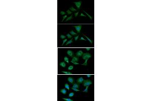 ICC/IF analysis of PKM2 in HeLa cells line, stained with DAPI (Blue) for nucleus staining and monoclonal anti-human PKM2 antibody (1:100) with goat anti-mouse IgG-Alexa fluor 488 conjugate (Green). (PKM 抗体  (AA 1-531))