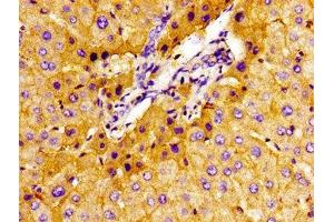 Immunohistochemistry (IHC) image for anti-Solute Carrier Family 22 (Organic Cation Transporter), Member 1 (SLC22A1) (AA 43-149) antibody (ABIN7170131)