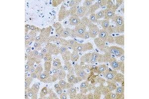 Immunohistochemistry of paraffin-embedded human liver injury using POMGNT1 antibody. (POMGNT1 抗体  (AA 411-660))