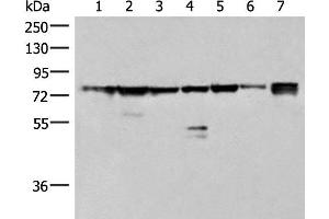 Western blot analysis of 231 K562 TM4 cell Mouse kidney tissue Mouse liver tissue Mouse brain tissue Hela cell lysates using THNSL1 Polyclonal Antibody at dilution of 1:500 (THNSL1 抗体)