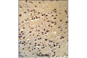 ALS2 Antibody (C-term) (R) IHC analysis in formalin fixed and paraffin embedded human brain tissue followed by peroxidase conjugation of the secondary antibody and DAB staining. (ALS2 抗体  (C-Term))