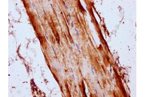 IHC image of ABIN7158674 diluted at 1:300 and staining in paraffin-embedded human skeletal muscle tissue performed on a Leica BondTM system. (LYRM4 抗体  (AA 1-91))
