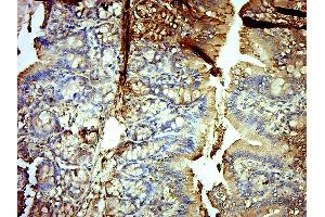Paraformaldehyde-fixed, paraffin embedded (Rat colon); Antigen retrieval by boiling in sodium citrate buffer (pH6. (GPD2 抗体  (AA 165-270))
