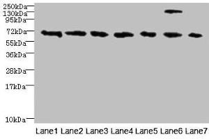 Western Blotting (WB) image for anti-Transient Receptor Potential Cation Channel, Subfamily M, Member 2 (TRPM2) (AA 60-119) antibody (ABIN7172859)