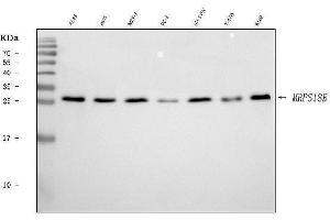Western blot analysis of MRPS18B using anti-MRPS18B antibody (ABIN7600740).