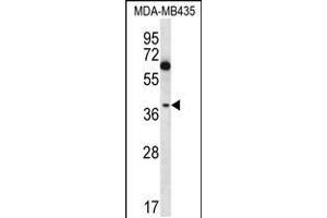 Western blot analysis in MDA-MB435 cell line lysates (35ug/lane). (NFKBIL1 抗体  (C-Term))