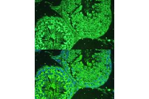 Immunofluorescence (IF) image for anti-Ankyrin Repeat, SAM and Basic Leucine Zipper Domain Containing 1 (ASZ1) (AA 1-350) antibody (ABIN7265617)