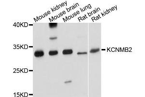 Western blot analysis of extract of various cells, using KCNMB2 antibody. (KCNMB2 抗体)