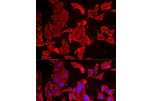 Immunofluorescence analysis of MCF7 cells using SMPX Polyclonal Antibody (SMPX 抗体)