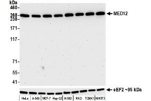 Western Blotting (WB) image for anti-Mediator Complex Subunit 12 (MED12) (AA 2127-2177) antibody (ABIN7453977) (Recombinant MED12 抗体  (AA 2127-2177))