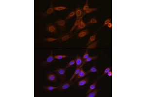 Immunofluorescence analysis of NIH-3T3 cells using RanG Rabbit mAb (ABIN7269846) at dilution of 1:100 (40x lens). (RANGAP1 抗体)