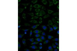 Immunofluorescence (IF) image for anti-NADH Dehydrogenase (Ubiquinone) 1 beta Subcomplex, 7, 18kDa (NDUFB7) (AA 1-137) antibody (ABIN6144480)
