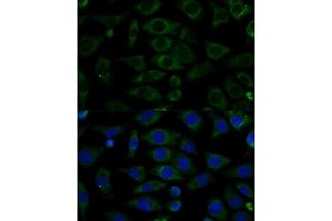Immunofluorescence analysis of L929 cells using NDUFB7 Polyclonal Antibody (ABIN6132403, ABIN6144480, ABIN6144481 and ABIN6217781) at dilution of 1:100 (40x lens). (NDUFB7 抗体  (AA 1-137))