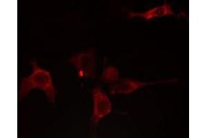 ABIN6275754 staining NIH-3T3 cells by IF/ICC. (GNE 抗体)