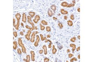 Immunohistochemistry (IHC) image for anti-Signal Transducer and Activator of Transcription 5A (STAT5A) (AA 744-794) antibody (ABIN7454017)