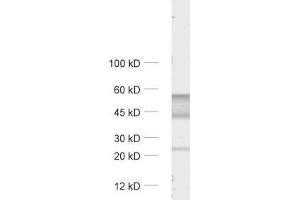 dilution: 1 : 1000, sample: unboiled rat cerebellum lysate (GABRA6 抗体  (AA 20-30))