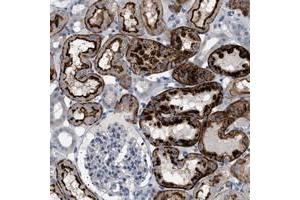 Immunohistochemical staining of human kidney with ADCY10 polyclonal antibody  shows strong positivity in tubuli at 1:20-1:50 dilution.