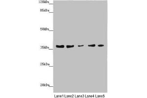 Western blot All lanes: MTHFD2 antibody at 4. (MTHFD2 抗体  (AA 40-250))