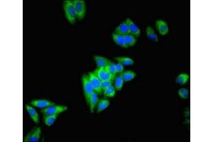 Immunofluorescent analysis of HepG2 cells using ABIN7149659 at dilution of 1:100 and Alexa Fluor 488-congugated AffiniPure Goat Anti-Rabbit IgG(H+L) (ECH1 抗体  (AA 36-135))