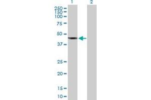 Western Blot analysis of SUDS3 expression in transfected 293T cell line by SUDS3 MaxPab polyclonal antibody. (SDS3 抗体  (AA 1-328))
