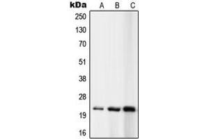 Western blot analysis of RPL10 expression in K562 (A), MCF7 (B), Ramos (C) whole cell lysates. (RPL10 抗体  (N-Term))
