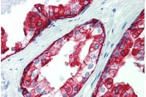 Prostate, Human: Formalin-Fixed, Paraffin-Embedded (FFPE) (Cytokeratin 19 抗体  (C-Term))