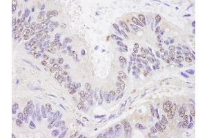 Immunohistochemistry (IHC) image for anti-BCL2-Associated Transcription Factor 1 (BCLAF1) (AA 150-200) antibody (ABIN7448448)