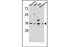 Western blot analysis of RIC3 Antibody (C-term) in NCI-H292,A549,WiDr,MDA-MB453 cell line lysates (35ug/lane). (RIC3 抗体  (C-Term))