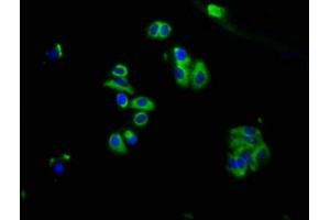 Immunofluorescence staining of HepG2 cells with ABIN7159436 at 1:66, counter-stained with DAPI. (GRM2 抗体  (AA 93-221))