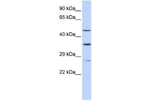 WB Suggested Anti-MEF2B Antibody Titration:  0. (MEF2B 抗体  (N-Term))
