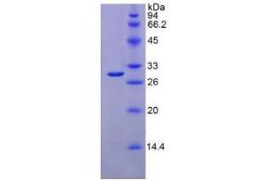 SDS-PAGE analysis of Mouse IFNa/bR1 Protein. (IFNAR1 蛋白)