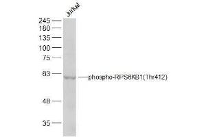 Image no. 3 for anti-Ribosomal Protein S6 Kinase, 70kDa, Polypeptide 1 (RPS6KB1) (pThr412) antibody (ABIN712991)