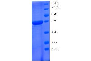 SDS-PAGE (SDS) image for Chemokine (C-C Motif) Ligand 5 (CCL5) (AA 24-91), (full length) protein (GST tag) (ABIN7479269)