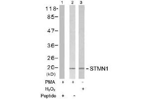 Image no. 2 for anti-Stathmin 1 (STMN1) (Ser15) antibody (ABIN197474) (Stathmin 1 抗体  (Ser15))