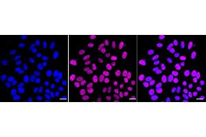 Immunocytochemical staining of HepG2 cells with RBBP4 antibody (ABIN7800185), 1:1,000). (Recombinant Retinoblastoma Binding Protein 4 抗体)