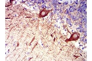 Immunohistochemical analysis of paraffin-embedded cerebellum tissues using RAB27B mouse mAb with DAB staining. (RAB27B 抗体  (AA 2-218))