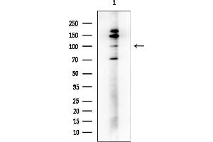 Western blot analysis of lysates from COLO205 cells, using SFRS8 Antibody at 1/1000 dilution.