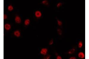 ABIN6266869 staining LOVO by IF/ICC. (TRIP13 抗体  (C-Term))