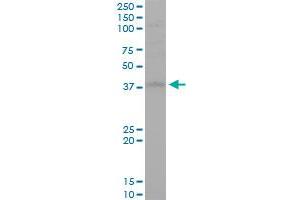 Western Blotting (WB) image for anti-serine/threonine/tyrosine Kinase 1 (STYK1) (AA 50-159) antibody (ABIN527521)