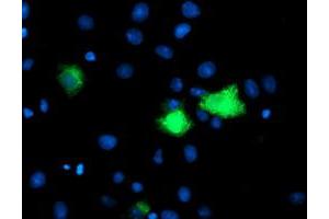 Image no. 1 for anti-Carboxypeptidase A1 (Pancreatic) (CPA1) antibody (ABIN1497591) (CPA1 抗体)