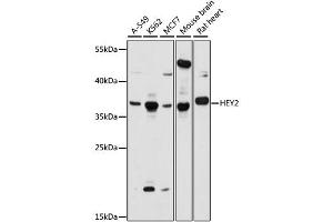 Western blot analysis of extracts of various cell lines, using HEY2 antibody (ABIN6294032) at 1:1000 dilution. (HEY2 抗体)