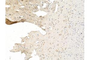 ABIN7094752 and ABIN7098803 at 1/100 staining Rat brain tissue by IHC-P. (NMNAT2 抗体  (C-Term))