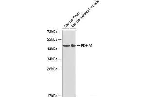 Western blot analysis of extracts of various cell lines using PDHA1 Polyclonal Antibody at dilution of 1:1000. (PDHA1 抗体)