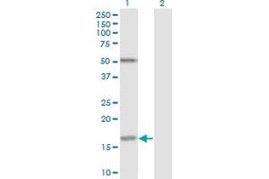 Western Blot analysis of FUT2 expression in transfected 293T cell line by FUT2 monoclonal antibody (M02), clone 4C12. (FUT2 抗体  (AA 51-150))