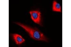 Immunofluorescent analysis of PEA15 staining in HEK293T cells. (PEA15 抗体)