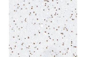 ABIN6266702 at 1/100 staining human brain tissue sections by IHC-P.