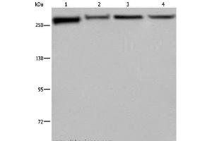 Western Blot analysis of PC3, Hela, NIH/3T3 and HUVEC cell using FLNA Polyclonal Antibody at dilution of 1:800 (Filamin A 抗体)