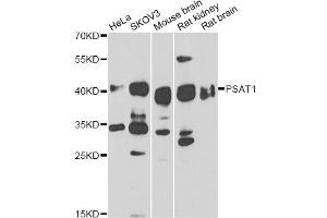 Western blot analysis of extracts of various cell lines, using PSAT1 antibody (ABIN6293473) at 1:1000 dilution. (PSAT1 抗体)